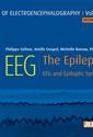 Atlas of electroencephalography Volume 2 : The Epilepsies. 2ED